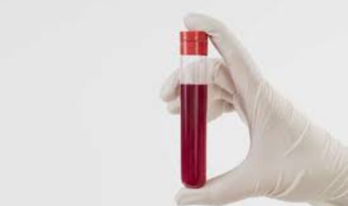 CBC Blood Test ka Meaning: Hb, WBC, Platelets report kaise samjhein