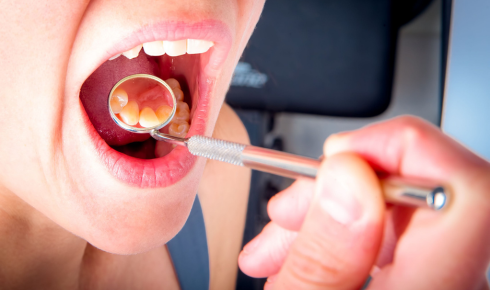 Gum Bleeding ke Real Reasons (aur kab dentist ko dikhana chahiye)